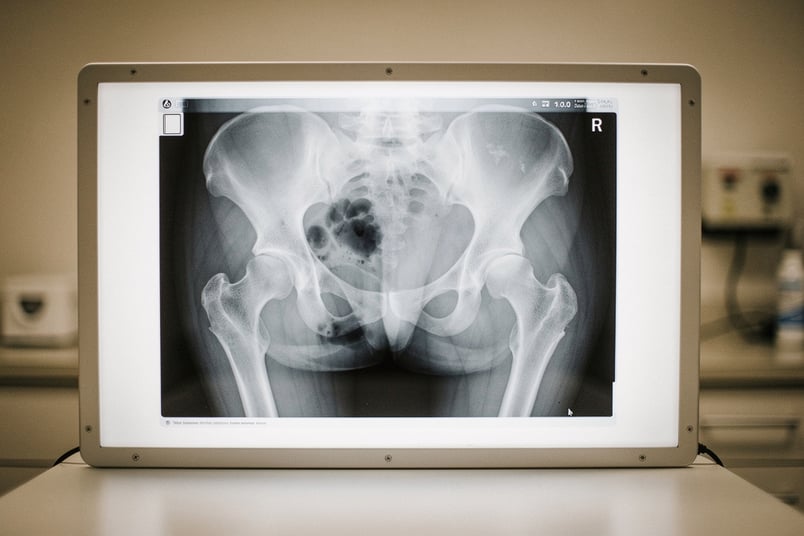 Bilateral condition in pet insurance — what it means and how it affects your coverage